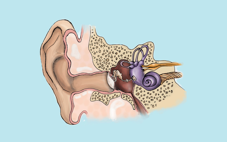 O ruído e a limpeza incorreta do ouvido colocam em risco a sua função