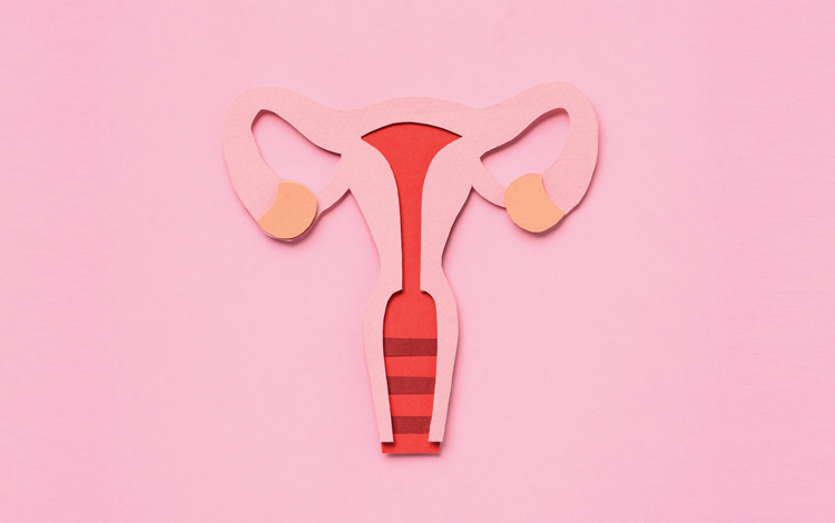 Endometriose: tudo o que tem de saber